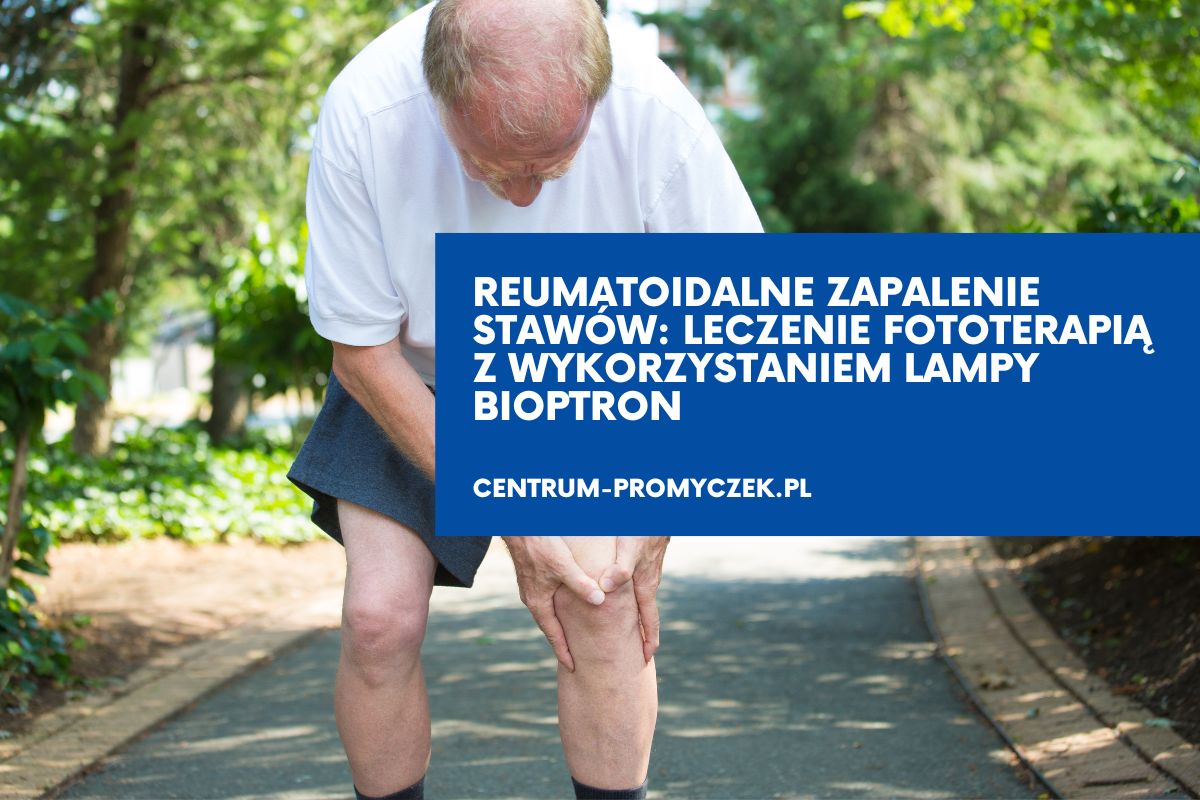 Reumatoidalne zapalenie stawów Leczenie fototerapią z wykorzystaniem lampy Bioptron